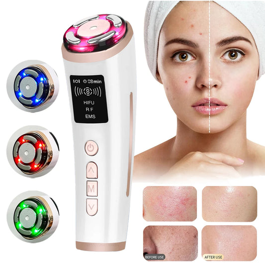 Hifu Face Lifting Machine Facial Massage EMS