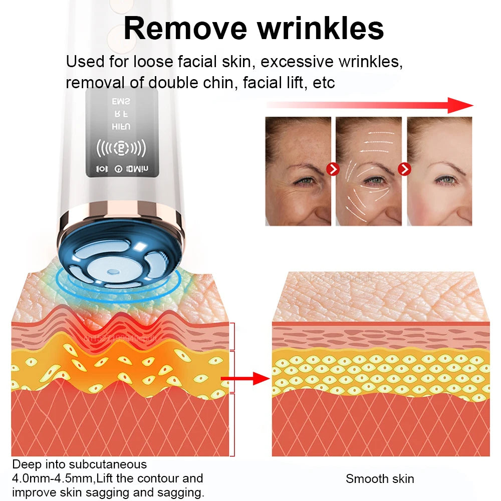 Hifu Face Lifting Machine Facial Massage EMS