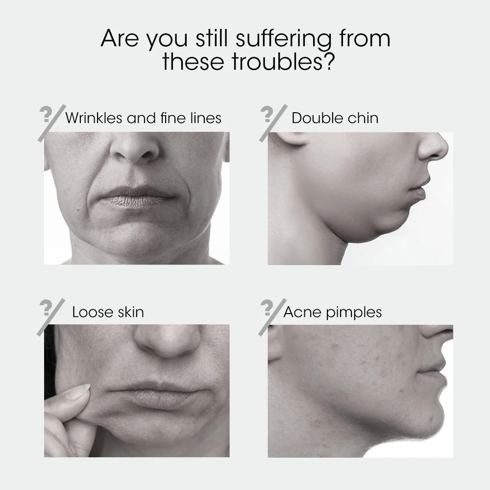 Electric V-Face Lifter EMS Facial Massage