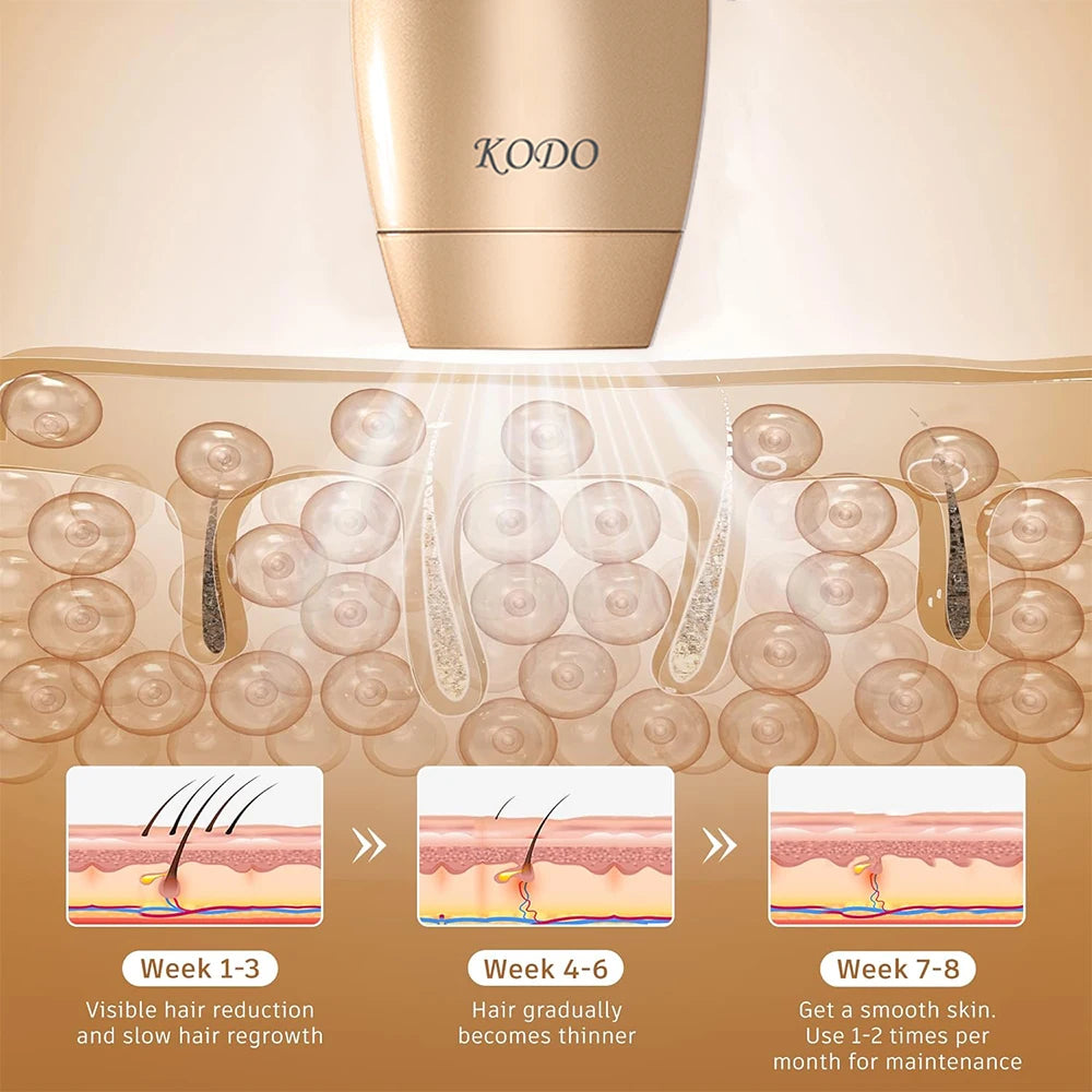 2026 High-end customization ice Laser Hair removal L