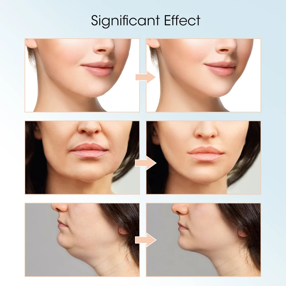 Electric V-Face Lifter EMS Facial Massage