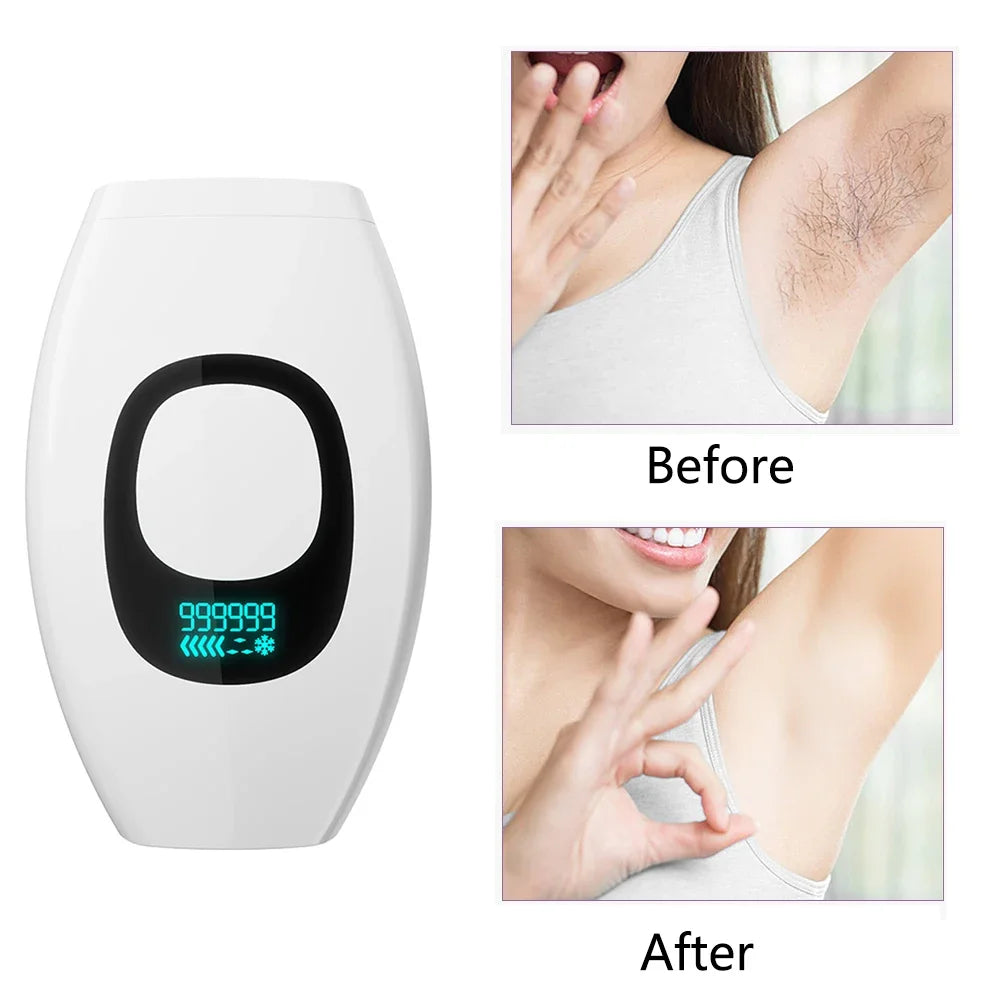 999,999 Flashes Bikinis IPL Pulses Epilator