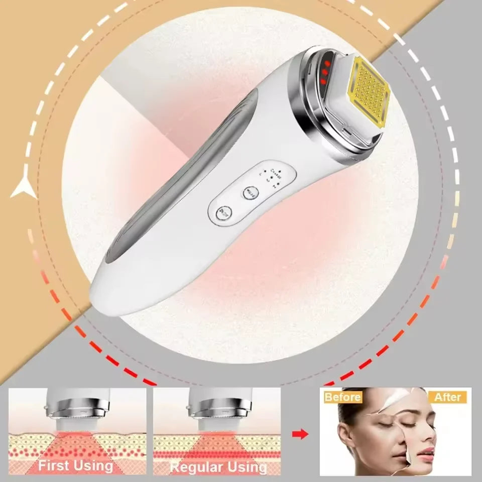 Radio Frequency Facial Lifting Machine