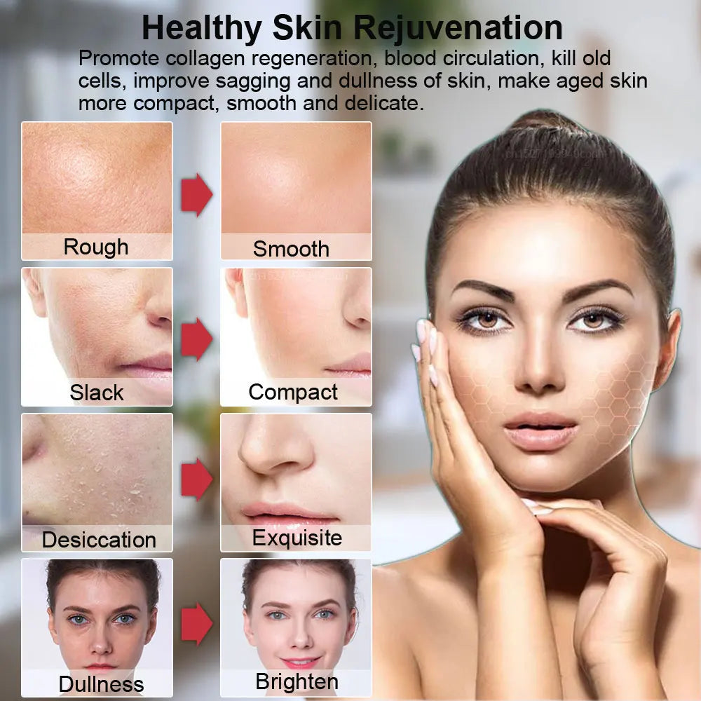 Hifu Face Lifting Machine Facial Massage EMS