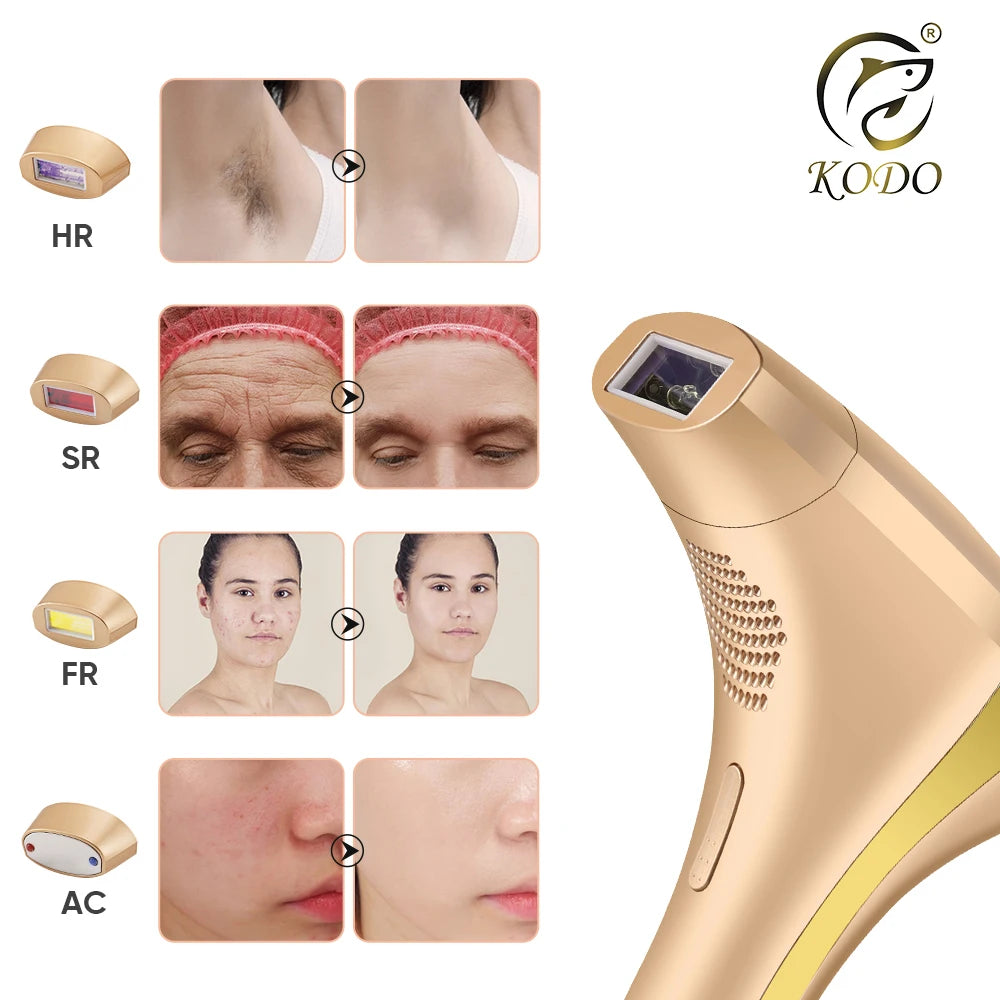 2026 High-end customization ice Laser Hair removal L